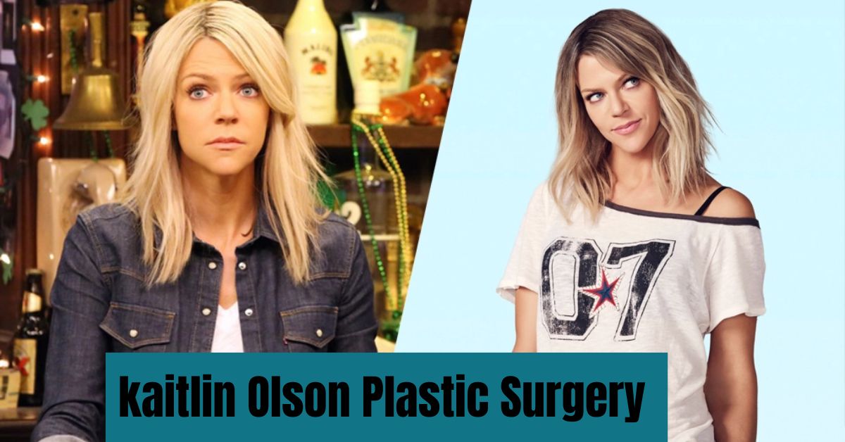 kaitlin Olson Plastic Surgery